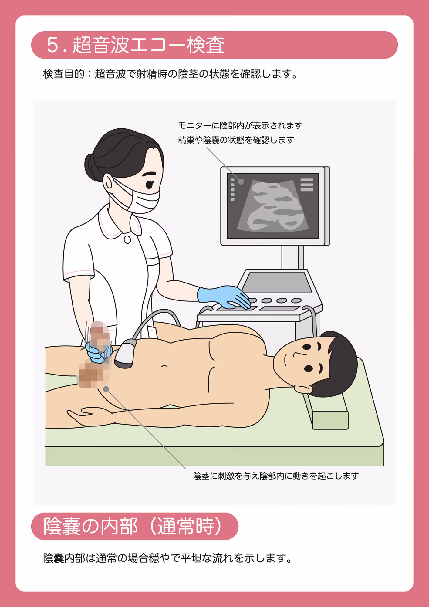 陰茎健診のご案内 サンプル画像 6枚目